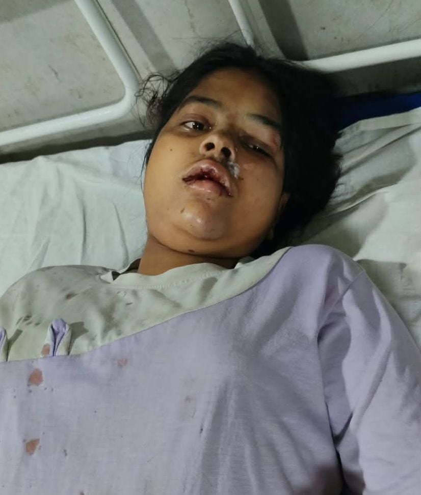 घायल प्रिया मौर्या