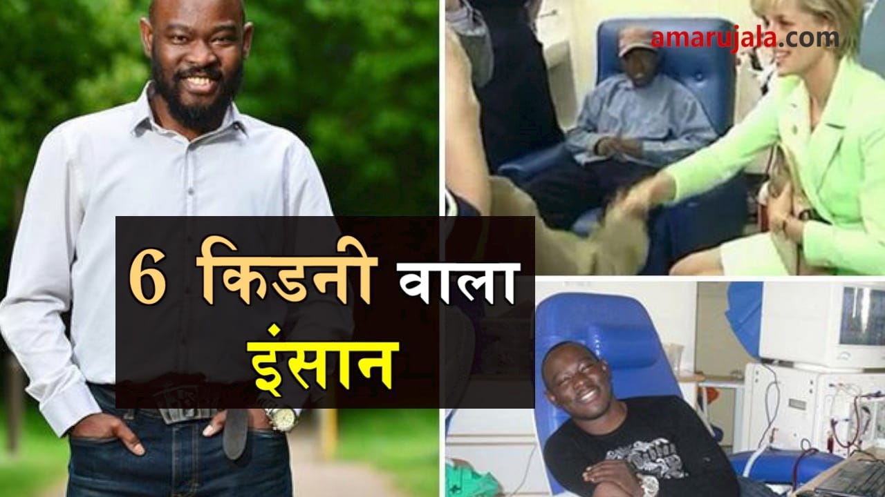 man with 6 kidney